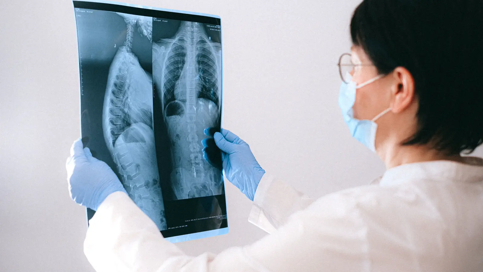 Médica com máscara e luvas analisa radiografia impressa, ilustrando a revisão humana do laudo de exame de imagem gerado com apoio de inteligência artificial