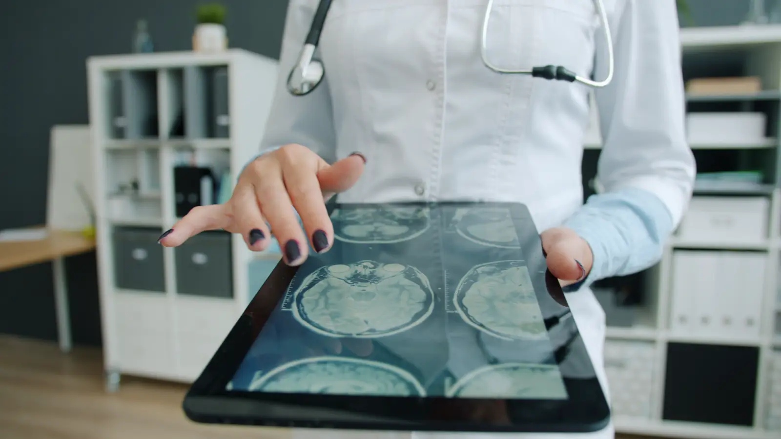Médica analisa imagem de exame em tablet com software de inteligência artificial, ilustrando sistema de diagnóstico que pode exigir registro na Anvisa